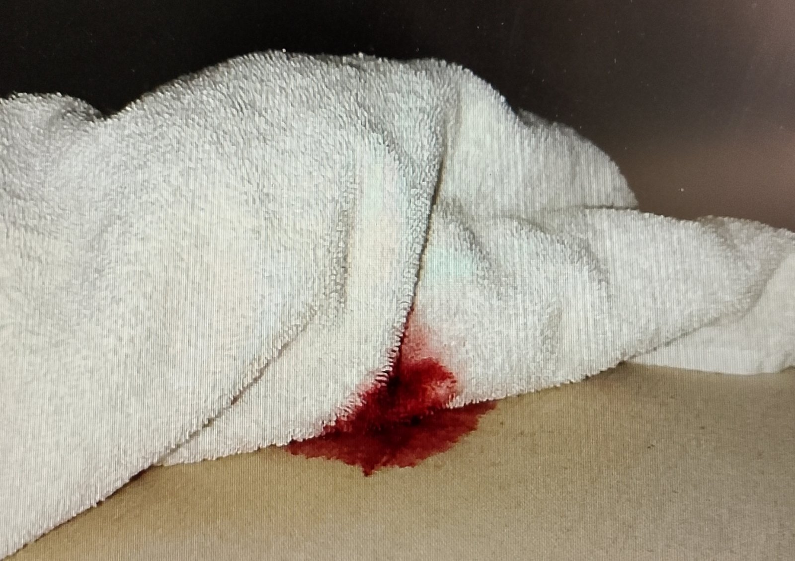 Blotting fresh blood stain on mattress with white cloth