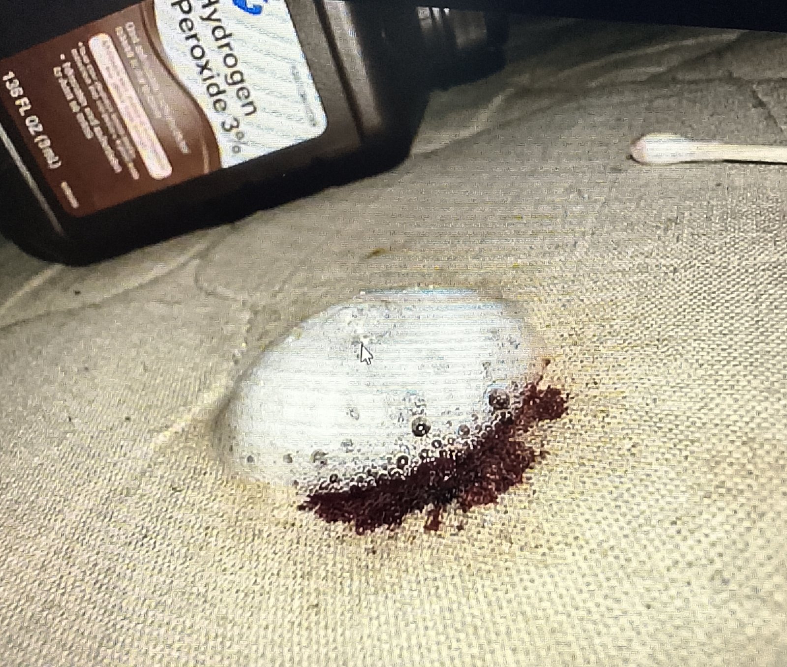 hydrogen Hydrogen peroxide fizzing on blood stain